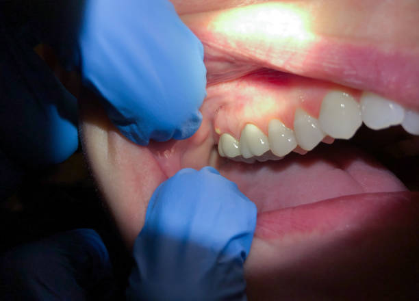 Best Urgent Tooth Repair  in Christopher, IL